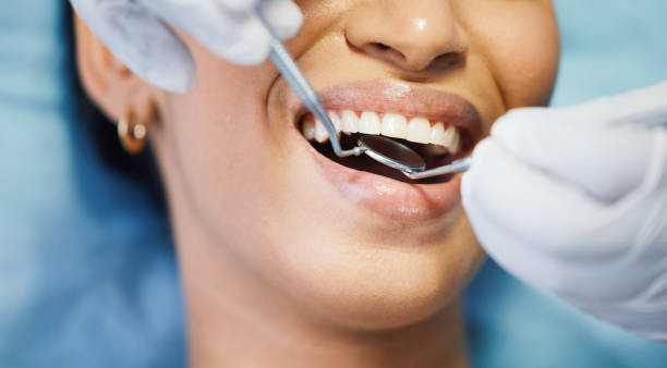 Best Emergency Broken Tooth Repair in Midland, TX